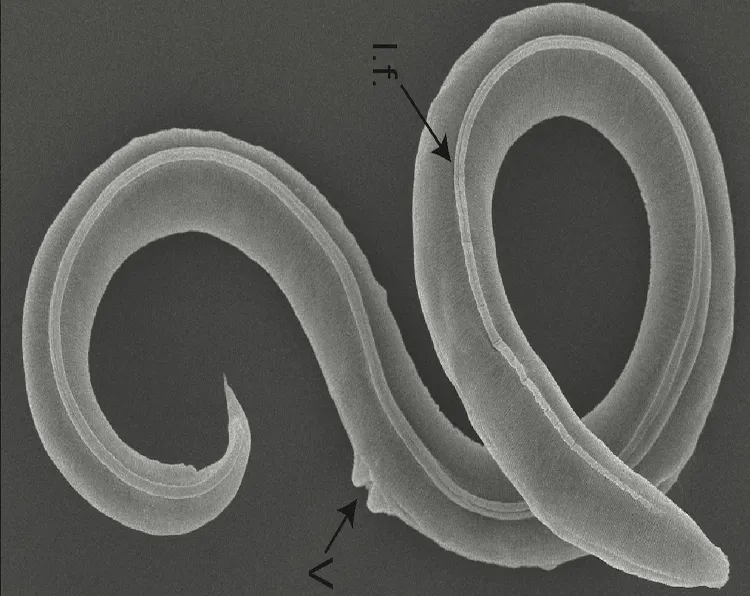 Image of a frozen worm (Representational)