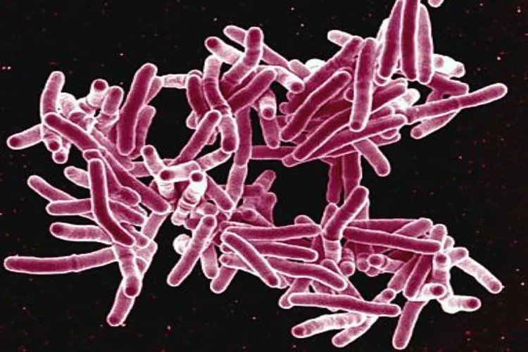 Scanning electron micrograph of Mycobacterium tuberculosis, the bacteria that cause TB