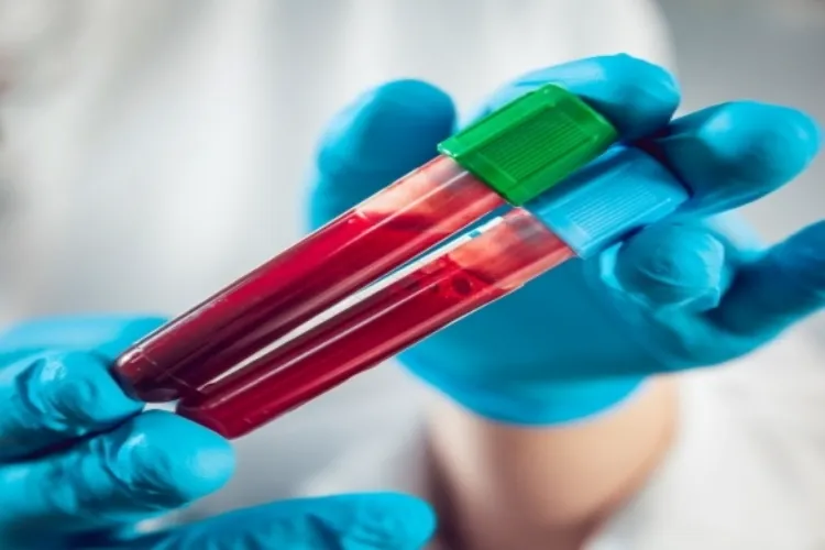 Indian startup develops AI-based blood test to detect 32 cancers early